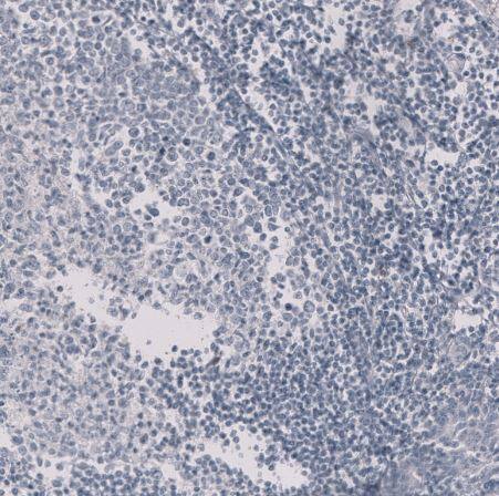 HE4/WFDC2 Antibody (CL12917)