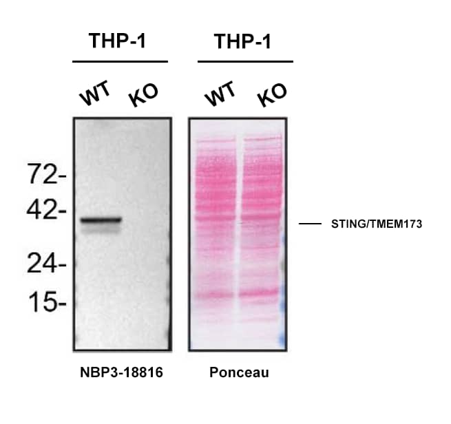 STING/TMEM173 Antibody (2922D)