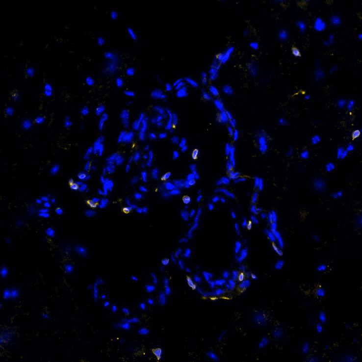 STING/TMEM173 Antibody (2922D) - BSA Free Multiplex Immunofluorescence: STING/TMEM173 Antibody (2922D) - BSA Free [NBP3-18816] -