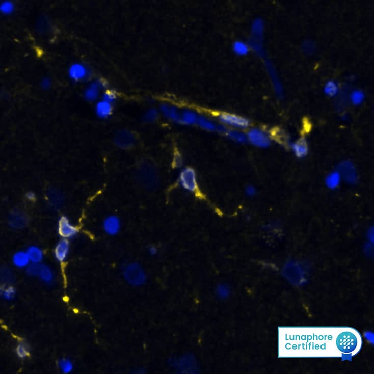 STING/TMEM173 Antibody (2922D)