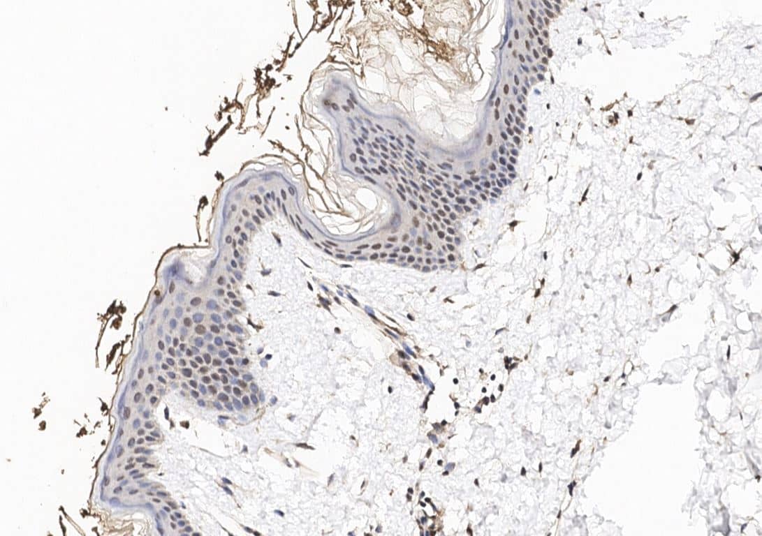 Nucleoporin 107 Antibody