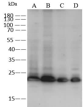 RAB11B Antibody