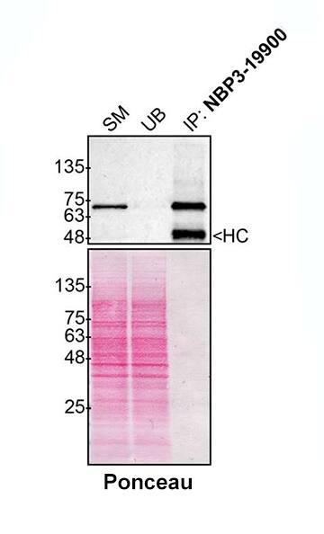 Optineurin Antibody (S01-2C5)