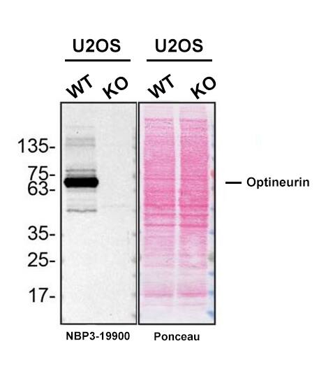 Optineurin Antibody (S01-2C5)