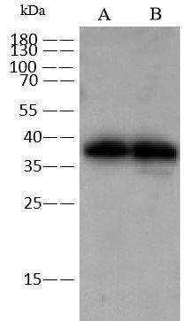 ADP-ribosylarginine hydrolase Antibody - Azide and BSA Free