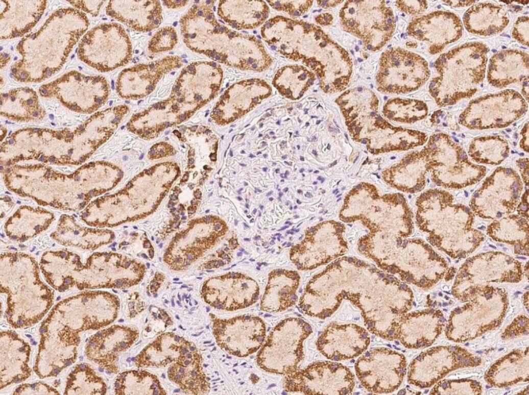 GNPNAT1 Antibody