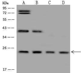 GNPNAT1 Antibody