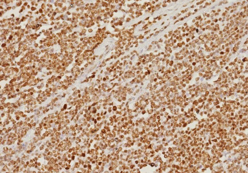 PMS2 Antibody (PMS2/8374R)