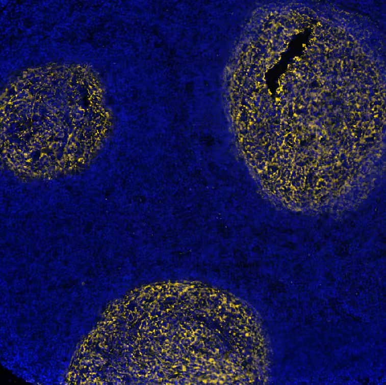 CD21 Antibody (CR2/7185R) CD21 Antibody (CR2/7185R)