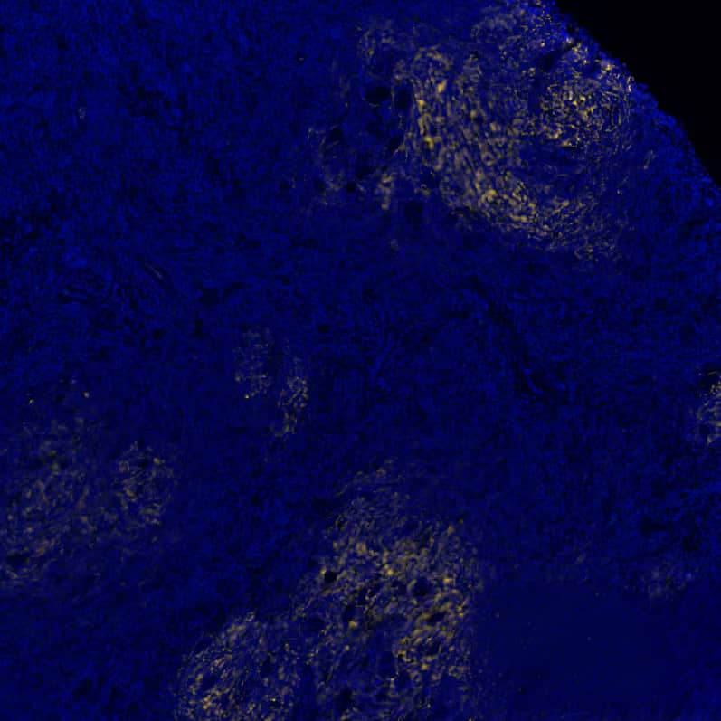 CD21 Antibody (CR2/7185R) CD21 Antibody (CR2/7185R)