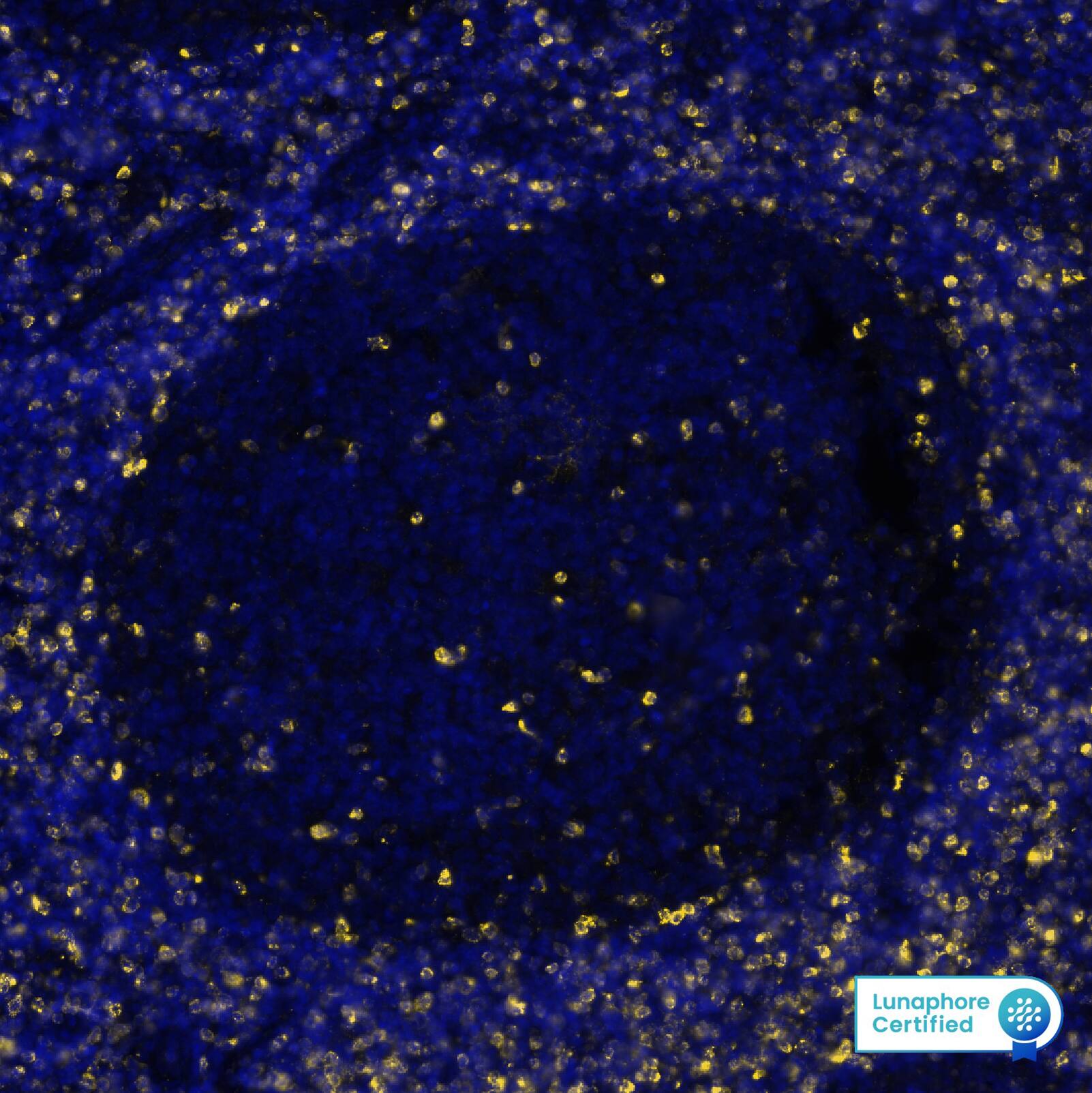 CTLA-4 Antibody (CTLA4/6864R)