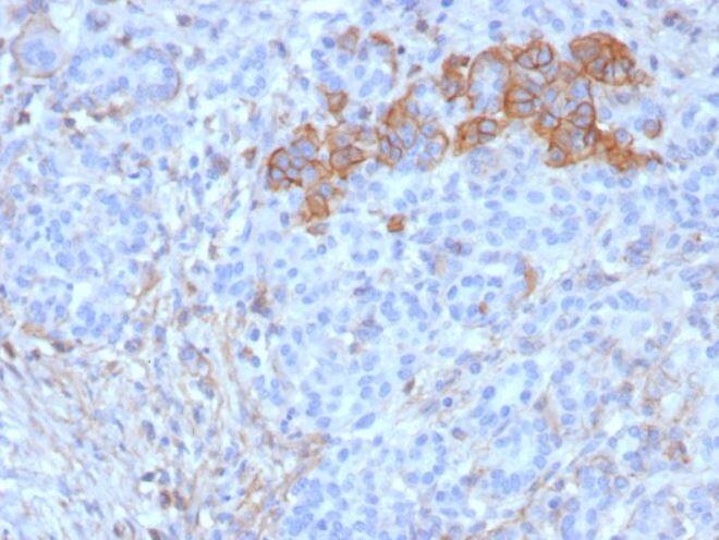 CD99 Antibody (rMIC2/6939)