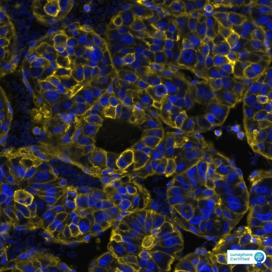 Detection of HLA-ABC/MHC I in Human Liver Tumor via seqIF™ staining on COMET™ HLA ABC Antibody (MHC-I/8366R) Detection of HLA-ABC/MHC I in Human Liver Tumor via seqIF™ staining on COMET™