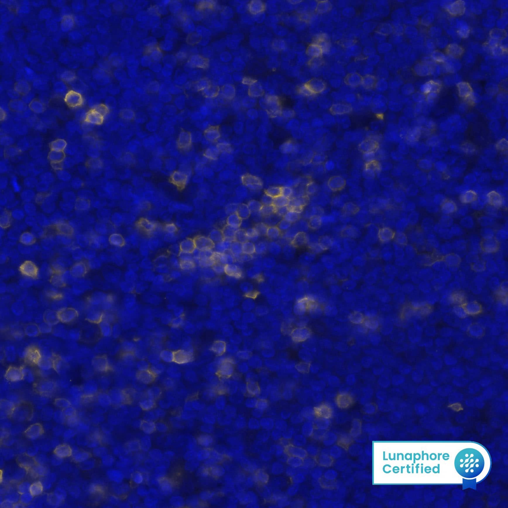 CD5 Antibody (CL12420) - BSA Free Detection of CD5 in Human Mantle Cell Lymphoma via seqIF&trade; staining on COMET&trade;