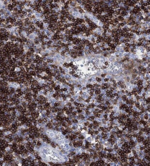 TDAG8/GPR65 Antibody - BSA Free