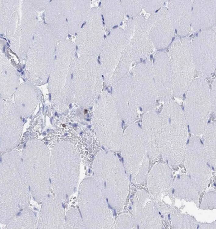 TDAG8/GPR65 Antibody - BSA Free