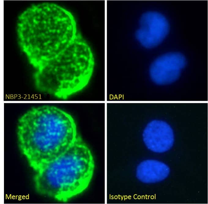 MUC1 Antibody (Mc5) - Chimeric