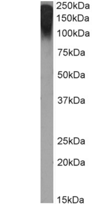 MUC1 Antibody (Mc5) - Chimeric