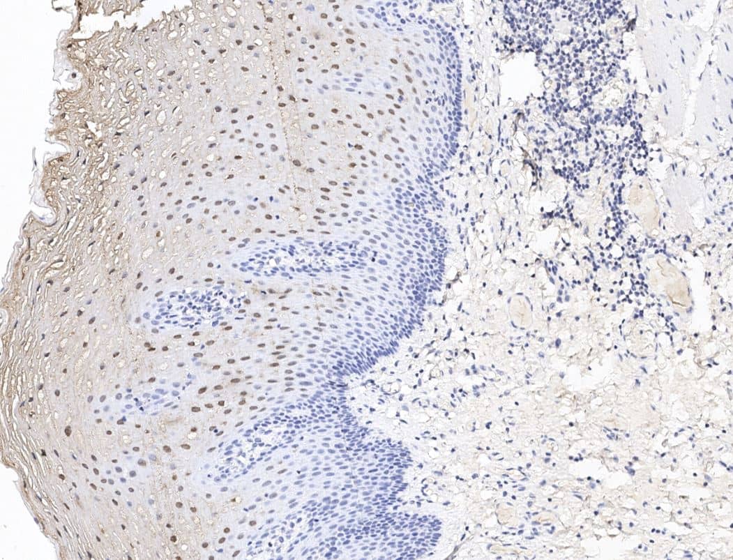 DPM2 Antibody