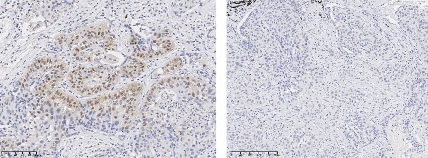 AKT1 [p Ser473] Antibody (0113)