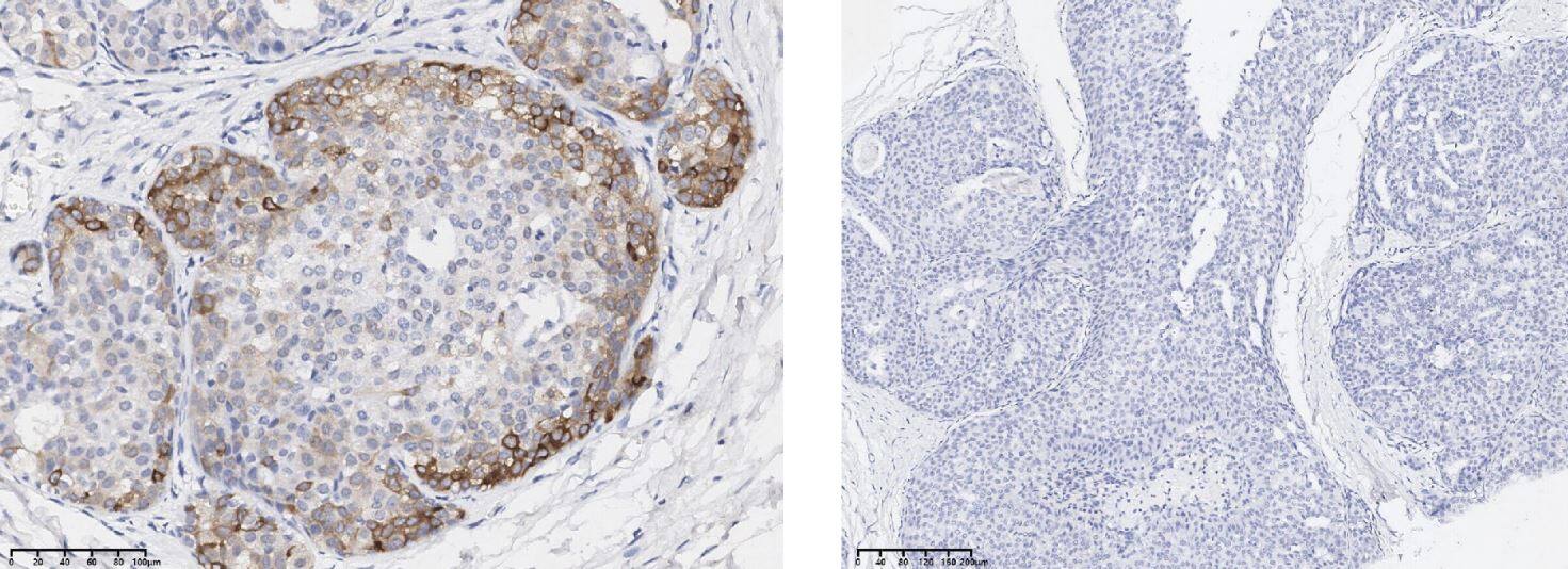 AKT1 [p Ser473] Antibody (0113)