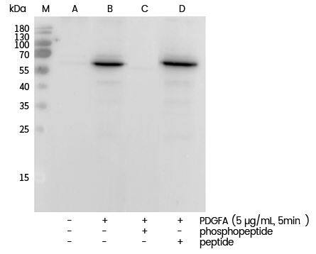 AKT1 [p Ser473] Antibody (0113)
