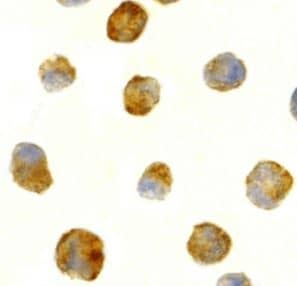 TEM8/ANTXR1 Antibody - BSA Free