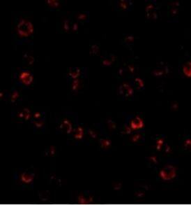 TEM8/ANTXR1 Antibody - BSA Free