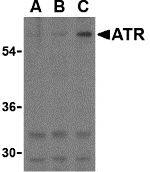 TEM8/ANTXR1 Antibody - BSA Free