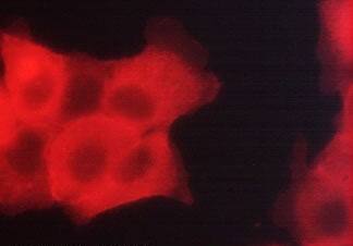 Annexin A2 Antibody (M009)