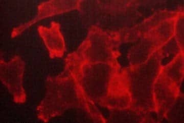 FXYD5/Dysadherin Antibody (M029)