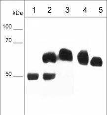 FXYD5/Dysadherin Antibody (M029)