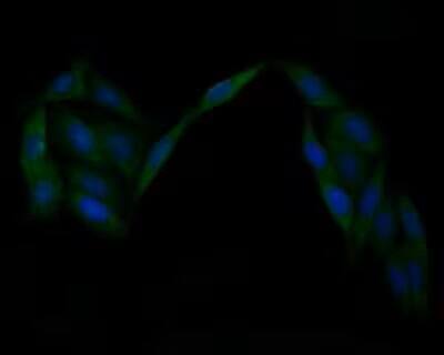 Integrin alpha V/CD51 Antibody (SC56-07)
