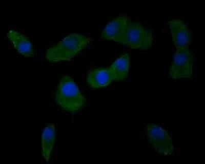 Integrin alpha V/CD51 Antibody (SC56-07)