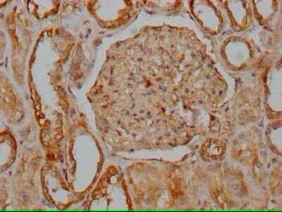 Integrin alpha V/CD51 Antibody (4G7)
