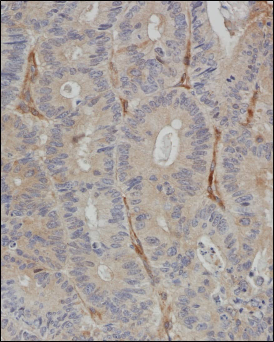 Optineurin Antibody Immunohistochemical Staining of Optineurin in Human Colon