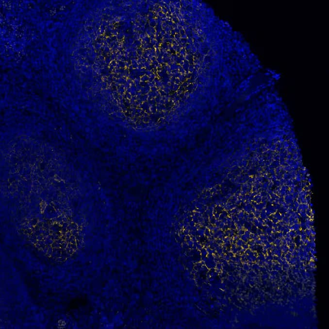 CD21 Antibody (CR2/7185R) CD21 Antibody (CR2/7185R)