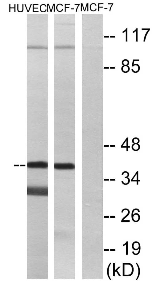 SUCNR1/GPR91 Antibody