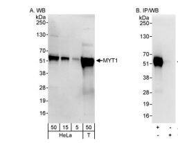 PKMYT1 Antibody