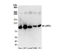 LAS1L Antibody