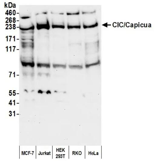 Capicua Antibody