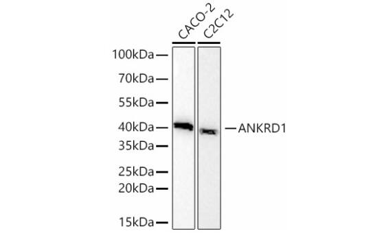 ANKRD1 Antibody (6C3I2)