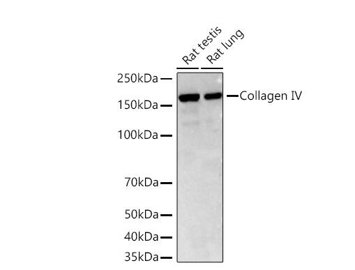 Collagen IV Antibody (3V3N3)