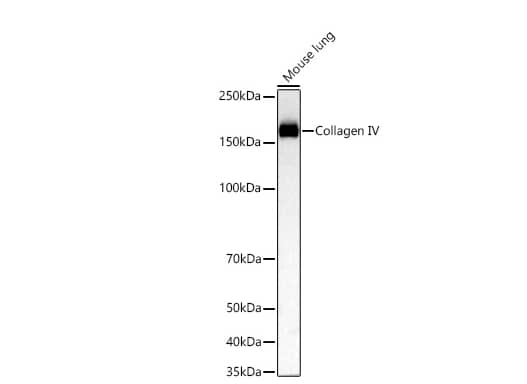 Collagen IV Antibody (3V3N3)