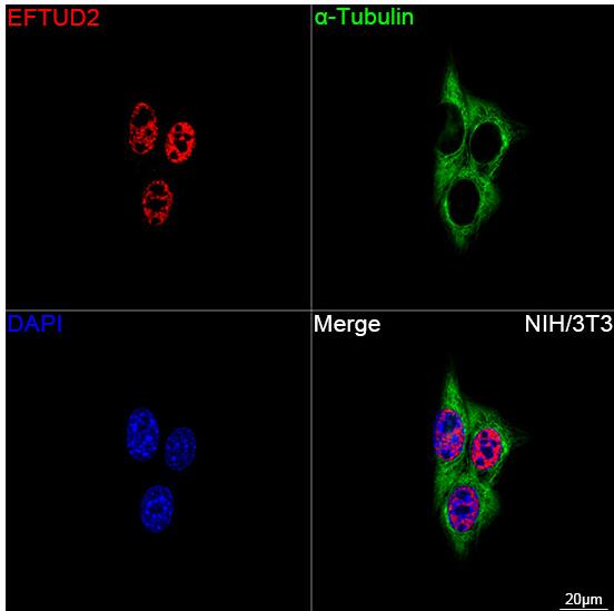 EFTUD2 Antibody (2Z1K3)