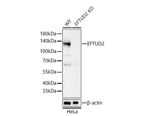 EFTUD2 Antibody (2Z1K3)