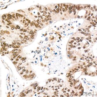 REPIN1 Antibody (2X2E9)