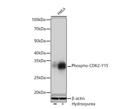CDK2 [p Tyr15] Antibody (7Z5H5)
