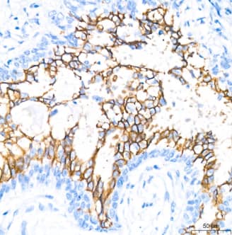 Aquaporin-4 Antibody (5A4W4)