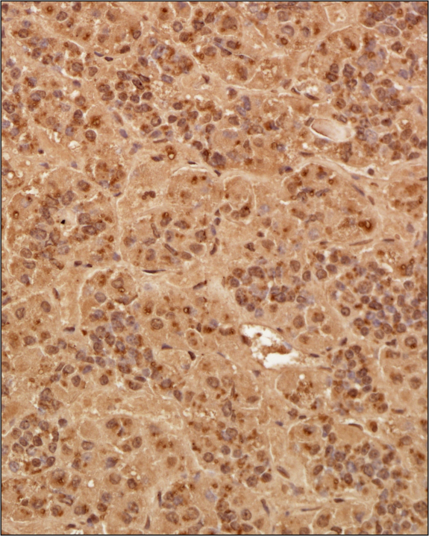 Pit1 Antibody